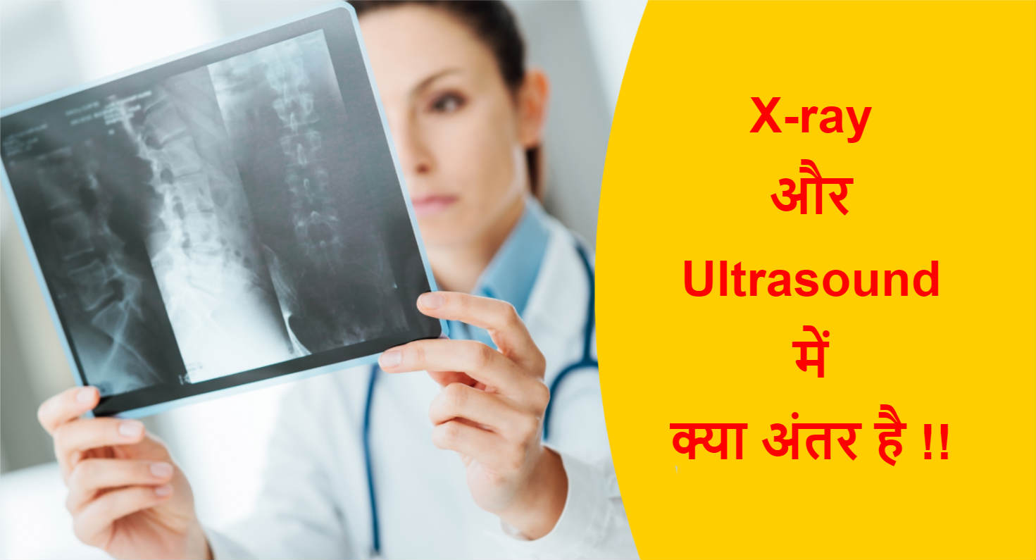Read more about the article X-ray और अल्ट्रासाउंड में क्या अंतर है !!