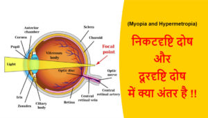 Read more about the article (Myopia & Hypermetropia) निकटदृष्टि दोष और दूरदृष्टि दोष में क्या अंतर है !!