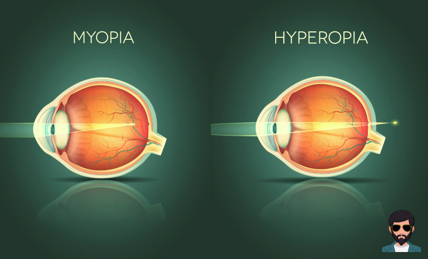 Difference between Myopia and Hypermetropia in Hindi | निकटदृष्टि दोष और दूरदृष्टि दोष में क्या अंतर है !!